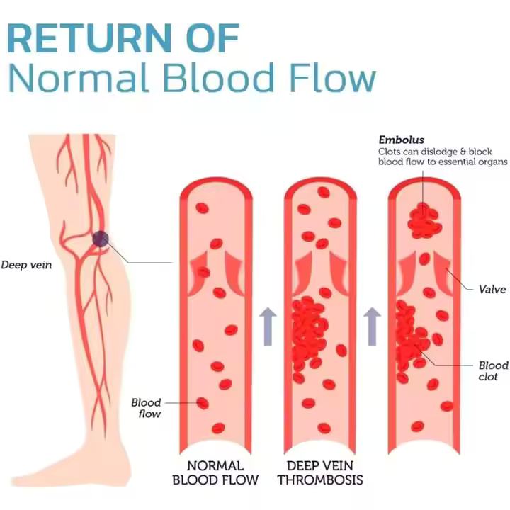 2 Kpl Silikonisia Polvitukia – Polvituet kompressiolla - Image 4