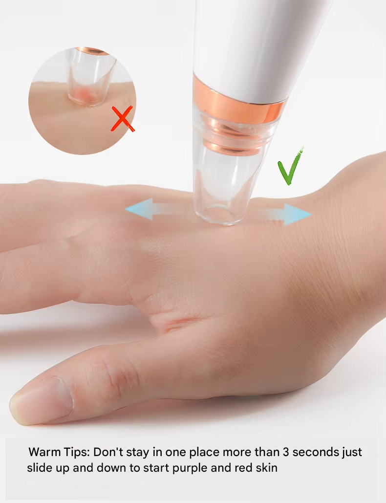 Polvituet urheiluun ja arkeen koko-opas -tarjoustaivas